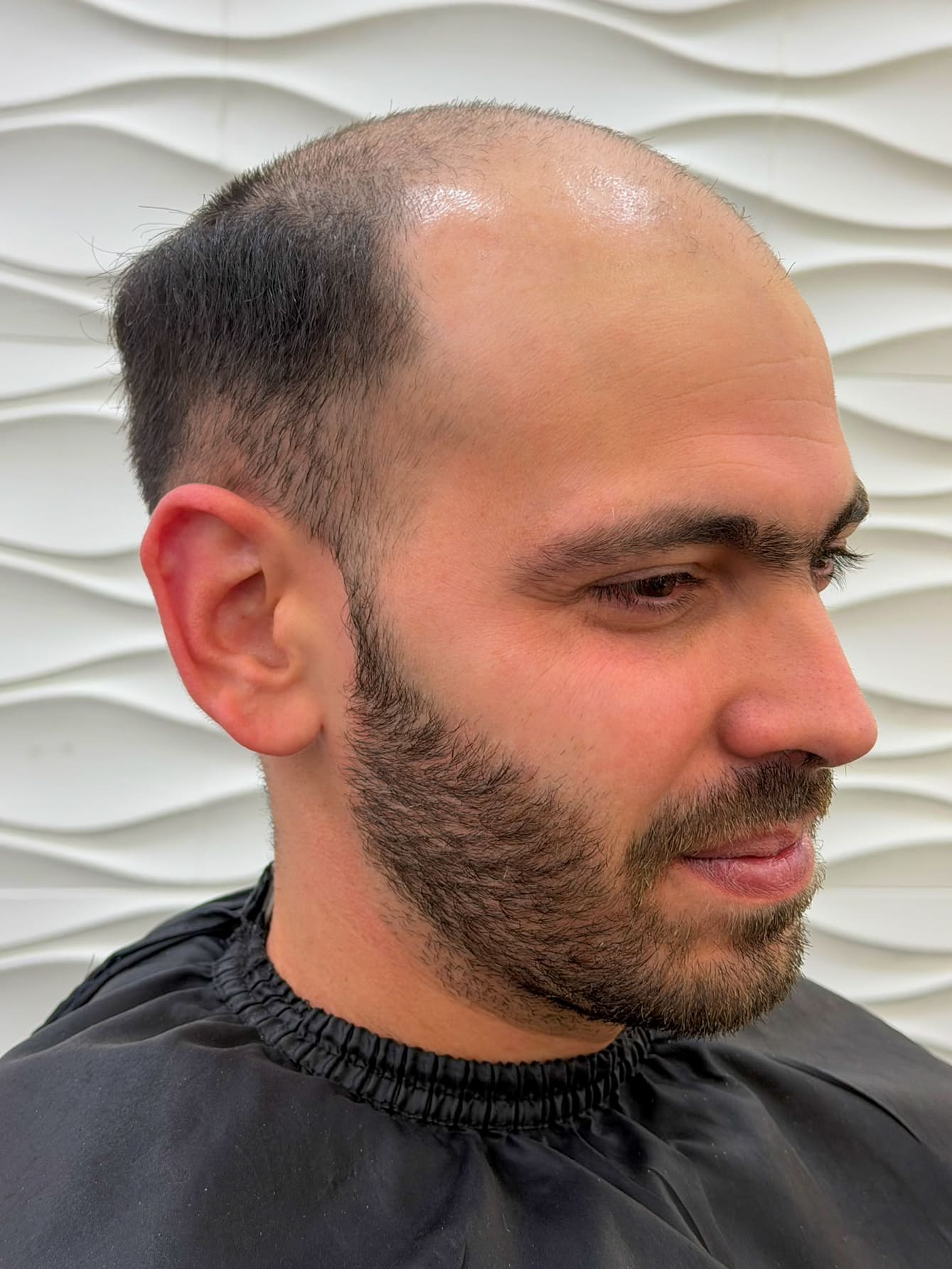 Daniel Sanchez de perfil: entradas profundas y la parte de arriba de la cabeza casi sin pelo.